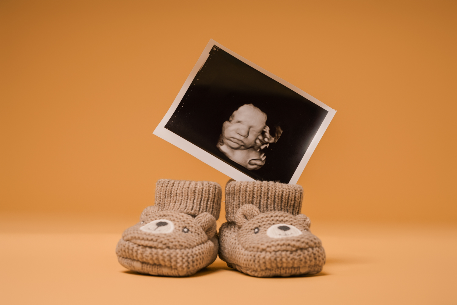 Babybauch & Newborn Foto Spelda Babybauch & Newborn Foto Spelda